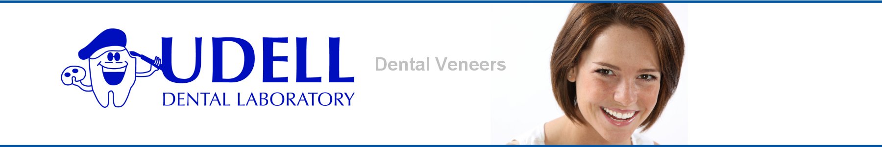 Udell Dental Laboratory Veneers
